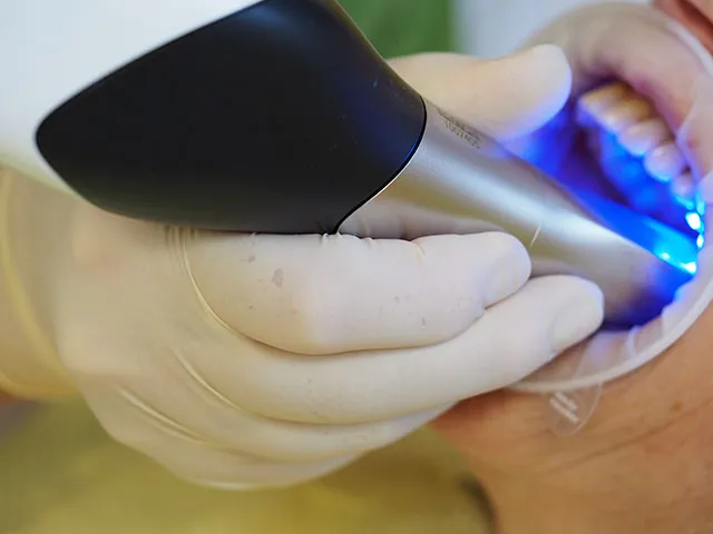 Detailaufnahme der CEREC-Schleifeinheit