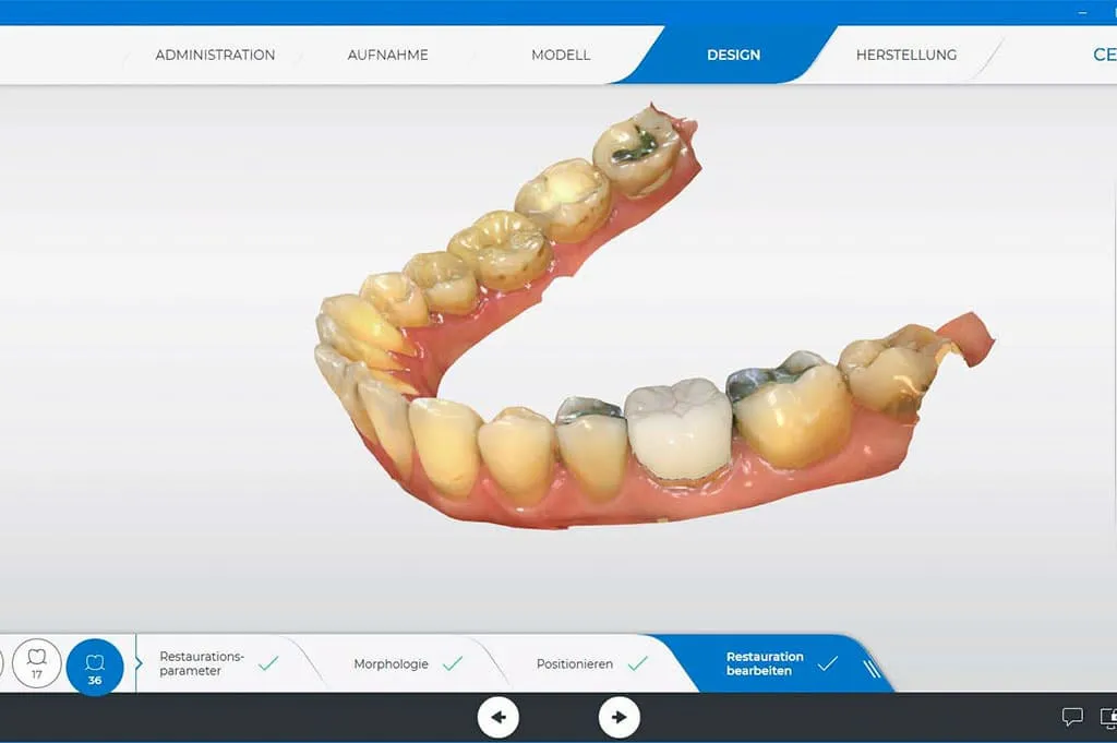 CEREC-Einheit für Keramikrestaurationen